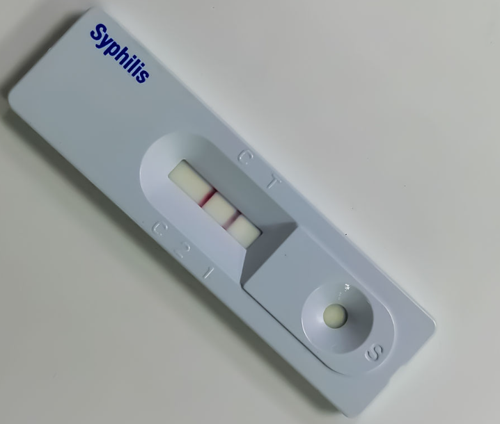 Striscia di prova rapida dell'antigene sifilide